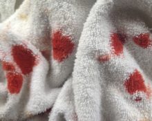 как удалить пятна крови с полотенца