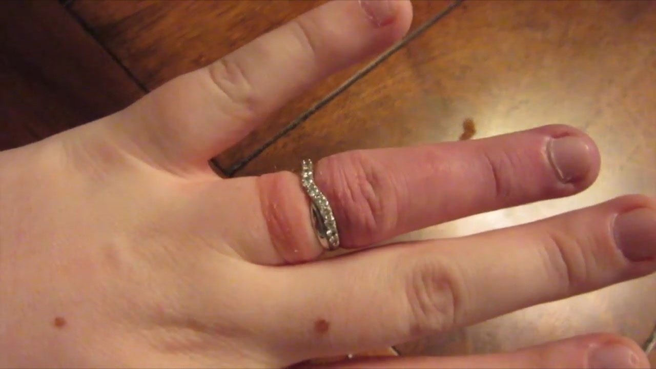 Что делать, если кольцо застряло на пальце
